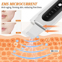Ultrasonic Skin Scrubber EMS Microcurrent Face Lifting - VirtuousWares:Global