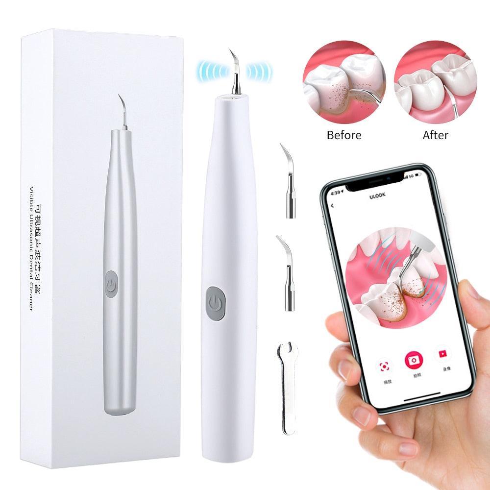 Ultrasonic Visual Dental Cleaning Teeth Whitening Kit Tartar - VirtuousWares:Global