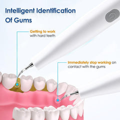 Ultrasonic Visual Dental Cleaning Teeth Whitening Kit Tartar - VirtuousWares:Global