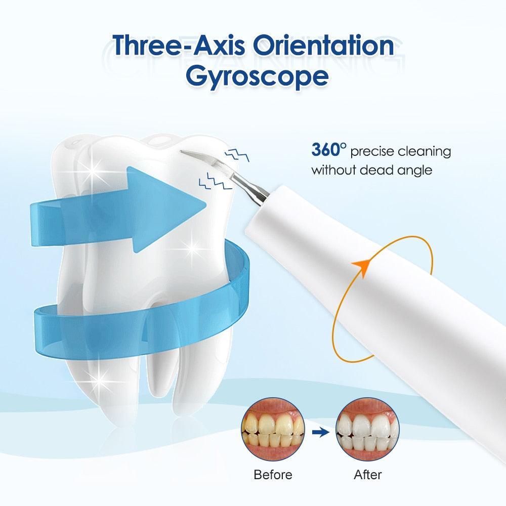 Ultrasonic Visual Dental Cleaning Teeth Whitening Kit Tartar - VirtuousWares:Global