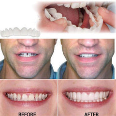 Whitening Braces Simulation Teeth Denture Brace - VirtuousWares:Global